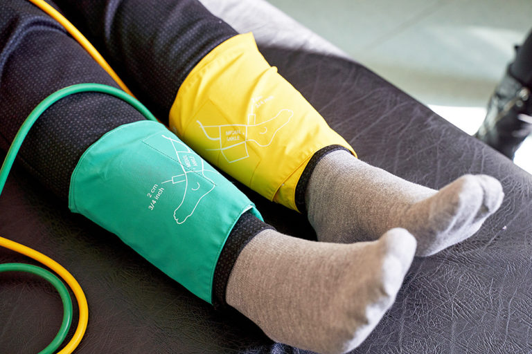 Peripheral Artery Disease (PAD) Treatment in Silver Spring